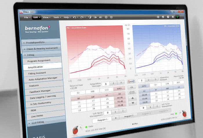 interface der software oasis von bernafon