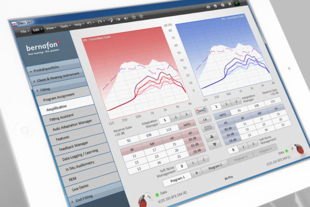screenshot der software oasis von bernafon